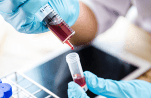 यूरिक एसिड टेस्ट ब्लड सैंपल कलेक्शन प्रक्रिया